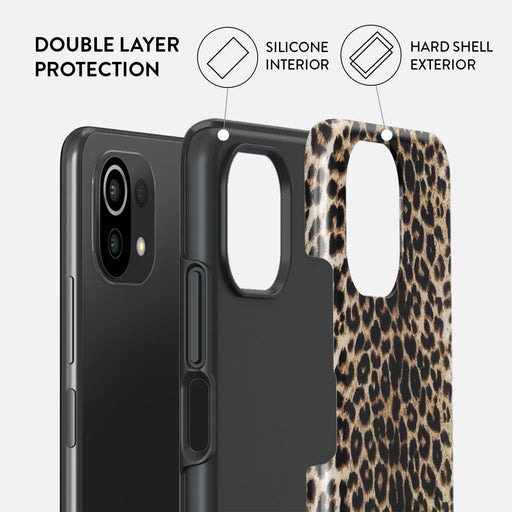 Player - Xiaomi Mi 11 Lite 4G / 5G Case 2
