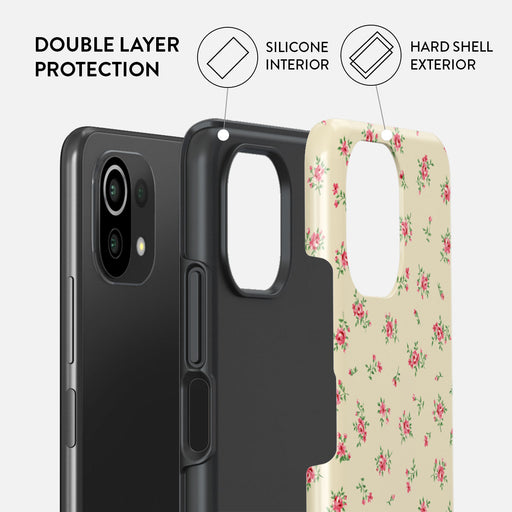 Sundress - Xiaomi 11 Lite 5G NE Case 2