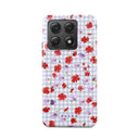 Idyllic - Xiaomi 14T Case 1