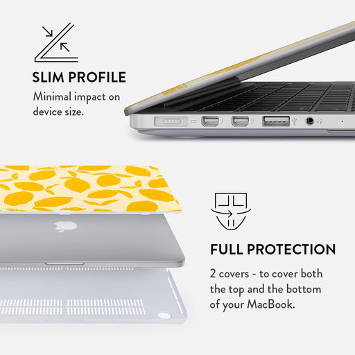 Lemon Tart - Macbook Case