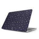 Midnight Kiss - Macbook Case 1