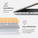 Sunny Bunny - Macbook Case 18