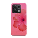 Island Girl - Xiaomi Redmi Note 13 5G Case 1
