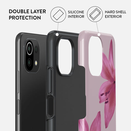 Fragile Beauty - Xiaomi Mi 11 Lite 4G / 5G Case 2