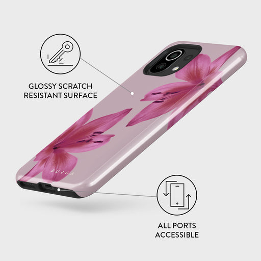 Fragile Beauty - Xiaomi Mi 11 Lite 4G / 5G Case 3