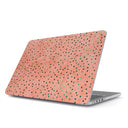 Watermelon Shake - Macbook Case