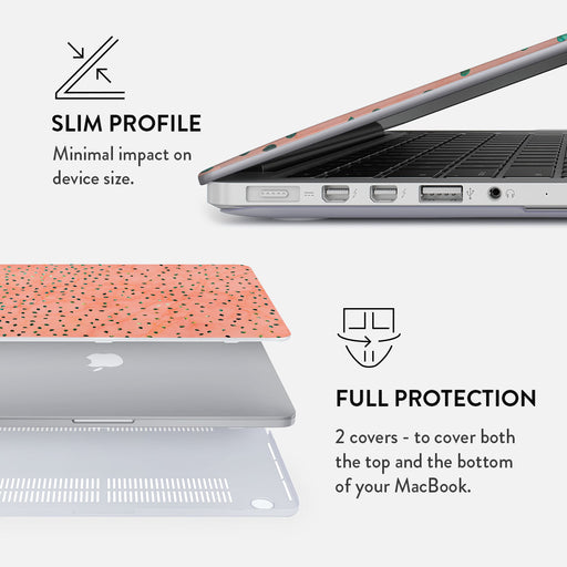 Watermelon Shake - Macbook Case 18