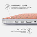 Watermelon Shake - Macbook Case 20