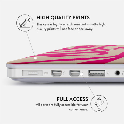 Siren - Macbook Case 20