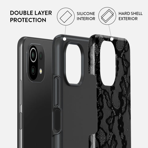 Magnetic - Xiaomi Mi 11 Lite 4G / 5G Case 2