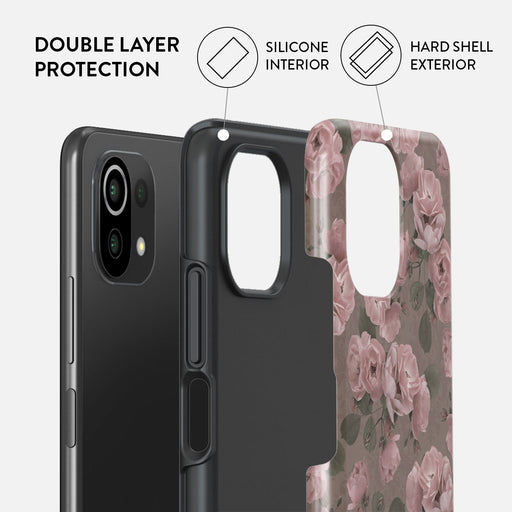 Vintage Glamour - Xiaomi 11 Lite 5G NE Case 2