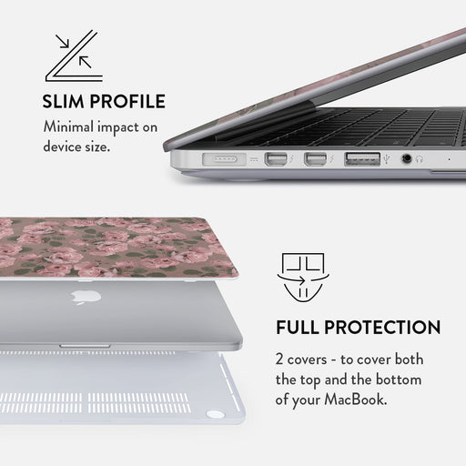 Vintage Glamour - Macbook Case 18