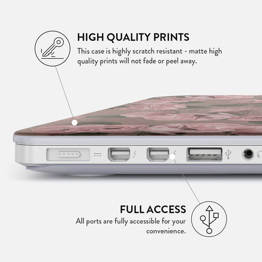 Vintage Glamour - Macbook Case 20