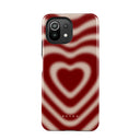 Sweet Affair - Xiaomi 11 Lite 5G NE Case 1