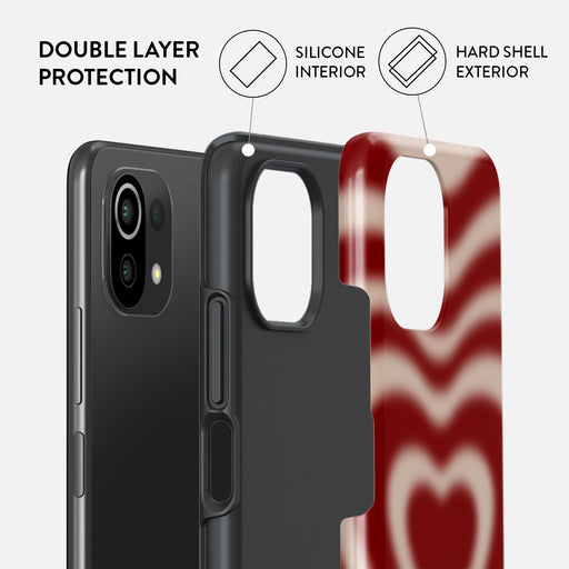 Sweet Affair - Xiaomi Mi 11 Lite 4G / 5G Case 2