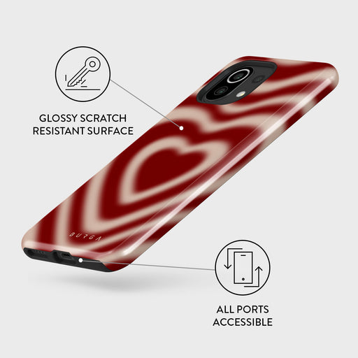 Sweet Affair - Xiaomi 11 Lite 5G NE Case 3