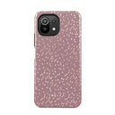 Hot Cocoa - Spotted Xiaomi 11 Lite 5G NE Case 1