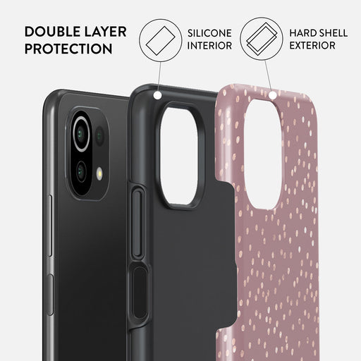 Hot Cocoa - Spotted Xiaomi 11 Lite 5G NE Case 2