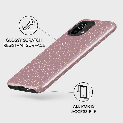 Hot Cocoa - Spotted Xiaomi 11 Lite 5G NE Case 3