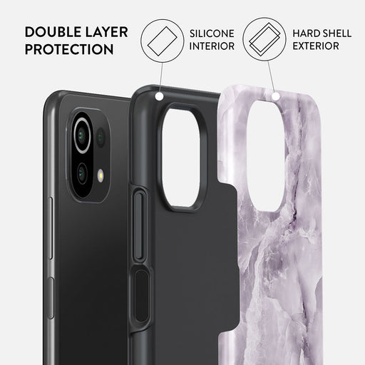 Black Currant - Xiaomi Mi 11 Lite 4G / 5G Case 2