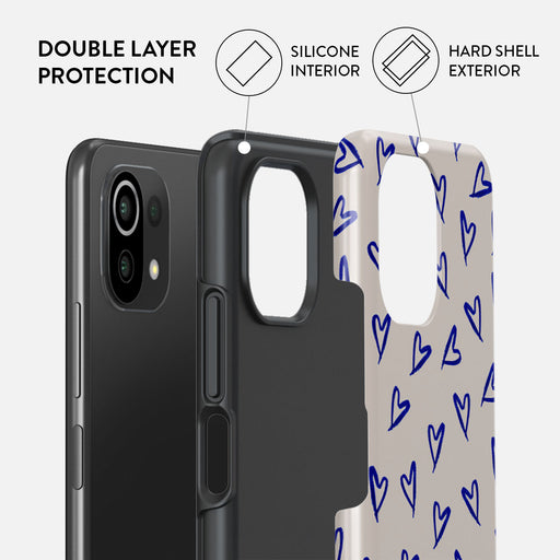 Love Me Right - Xiaomi Mi 11 Lite 4G / 5G Case | BURGA