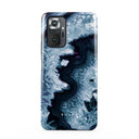 Frozen Lake - Gray Marble Xiaomi Redmi Note 10 Pro Case